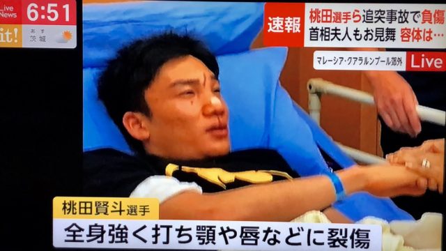 桃田賢斗 回復傾向【画像・動画】 ネットの反応は