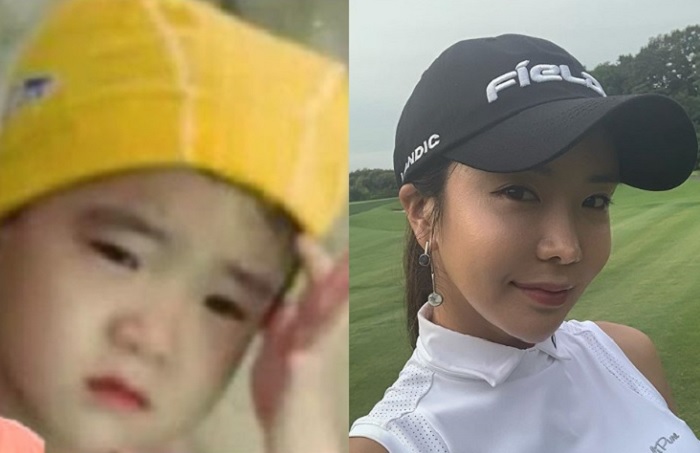 アンシネ整形外科前後